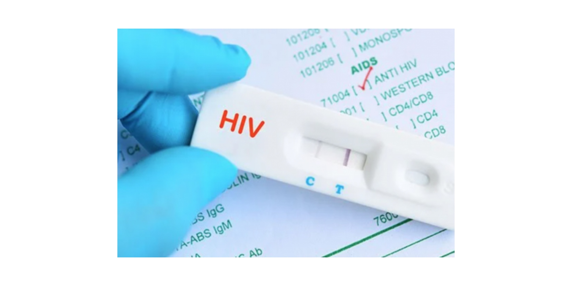 How to use hiv strip