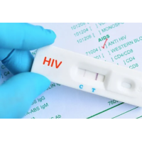 How to use hiv strip