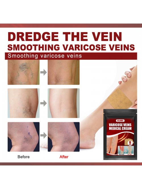 Vein Massage Varicose Plaster (3 boxes of value pa...