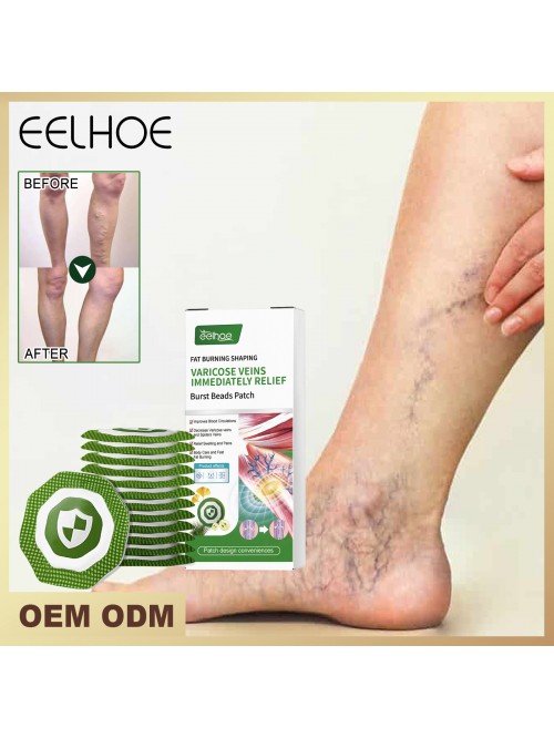 Chinese medicine intravenous patch relieves varicose veins and relieves leg muscle swelling