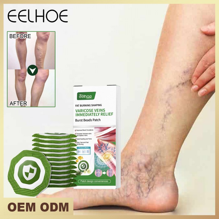 Chinese medicine intravenous patch relieves varicose veins and relieves leg muscle swelling