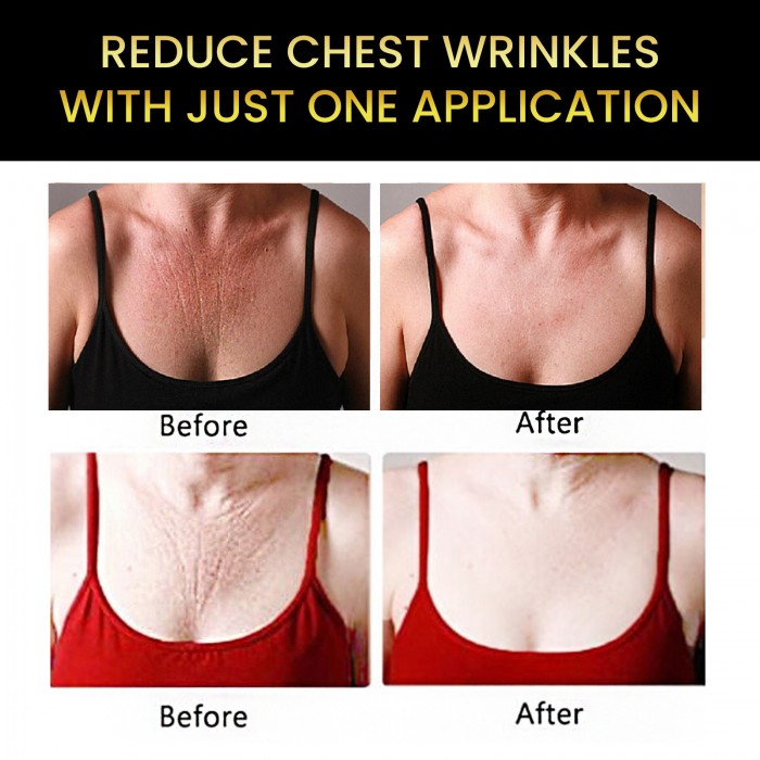 Breast anti-wrinkle patch (3 boxes of value pack) Reduce breast wrinkles Moisturize and firm cleavage skin Moisturizing silicone patch